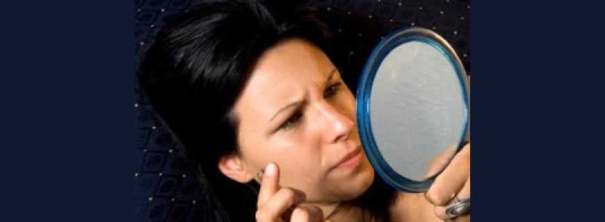 Kıllanma Artışı (Hirsutism)